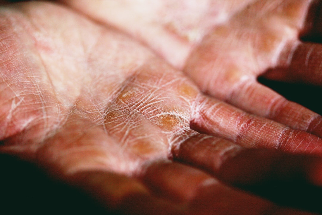 Photo skin diseases