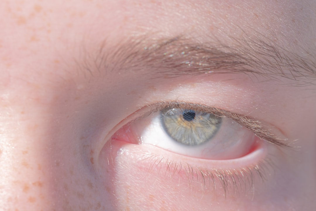Photo skin conditions around the eyes