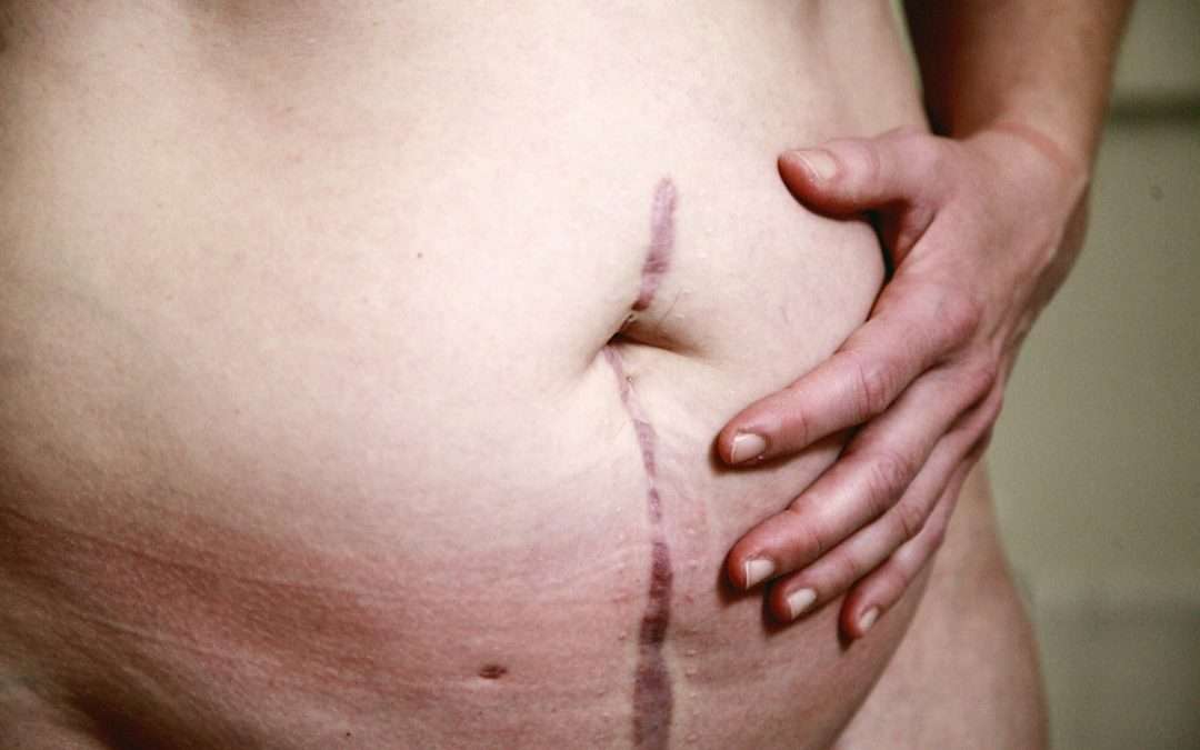 Photo skin disease