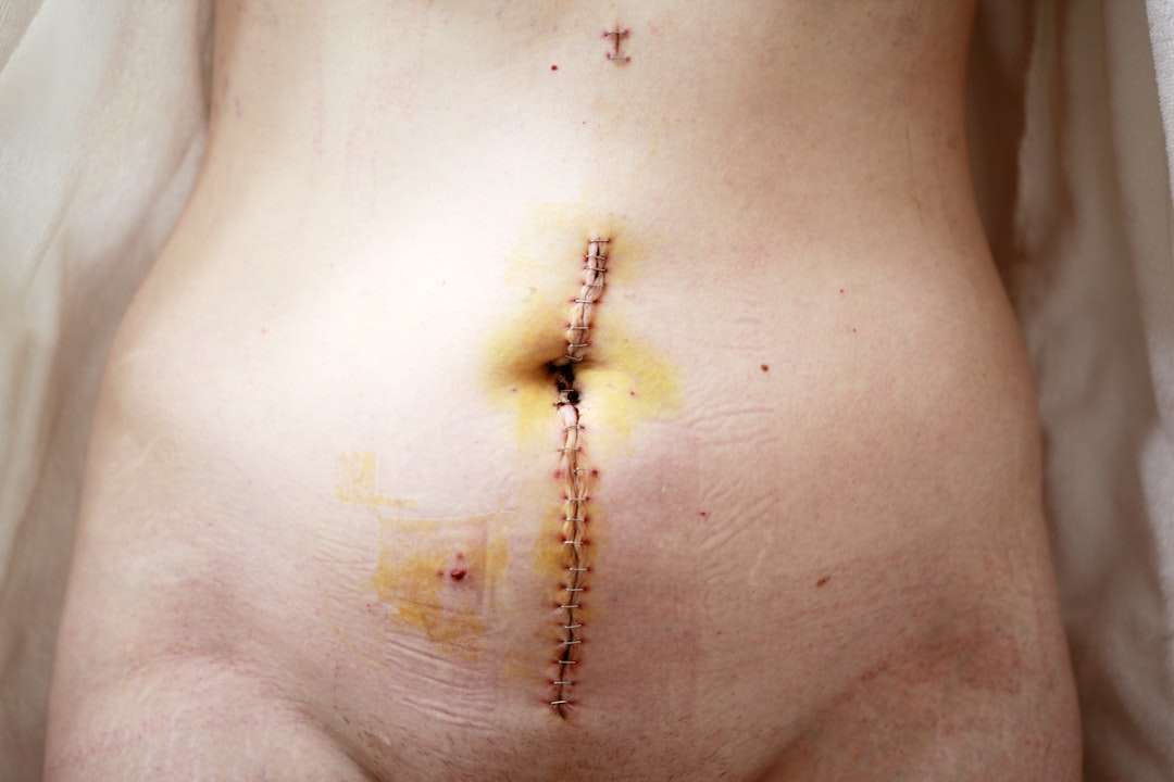 Photo skin diseases