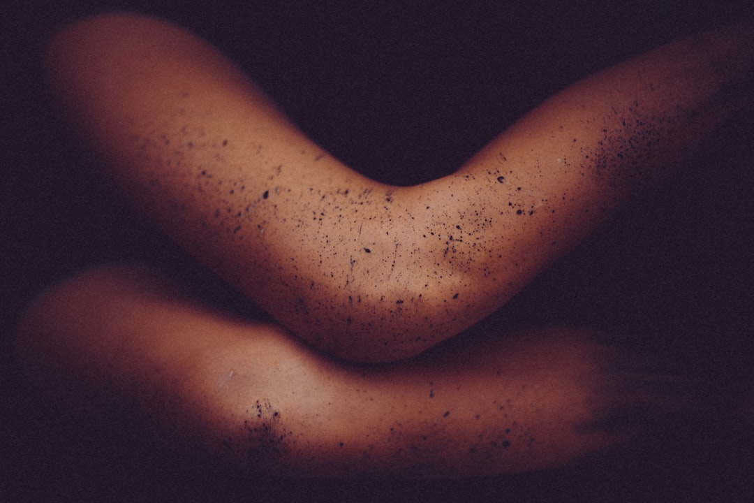 Photo skin diseases