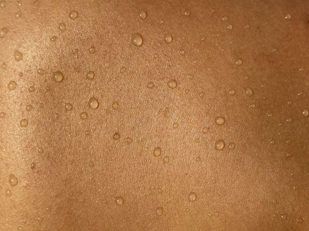 Photo skin diseases