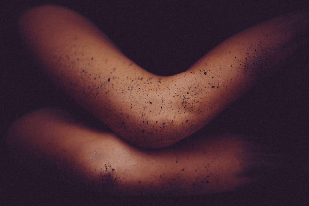 Photo skin diseases