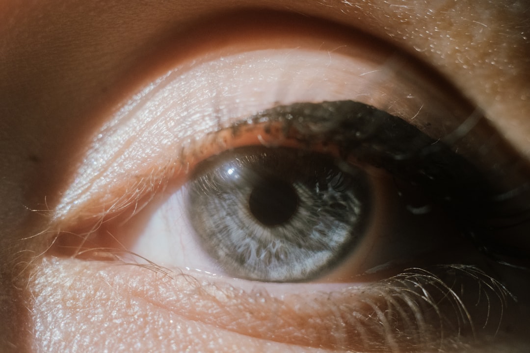 Photo skin conditions around the eyes