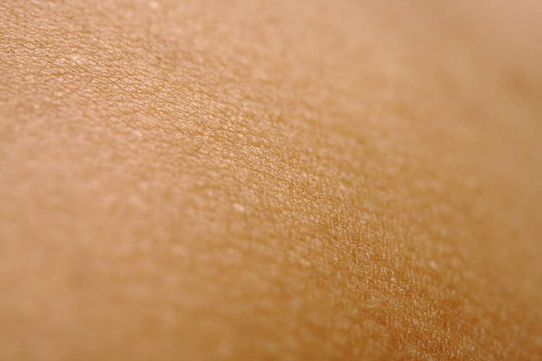 Photo skin diseases