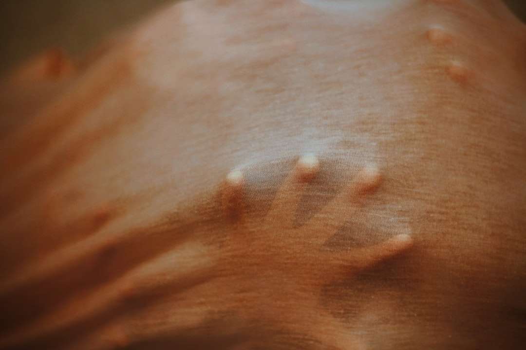 Photo skin disease